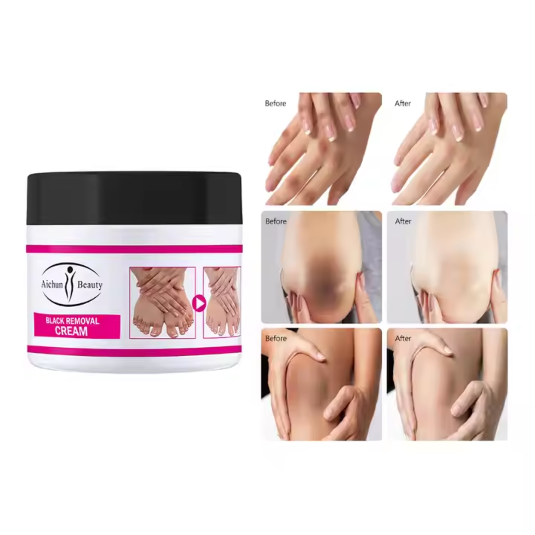 Aichun Joint Black Removal Whitening Cream
